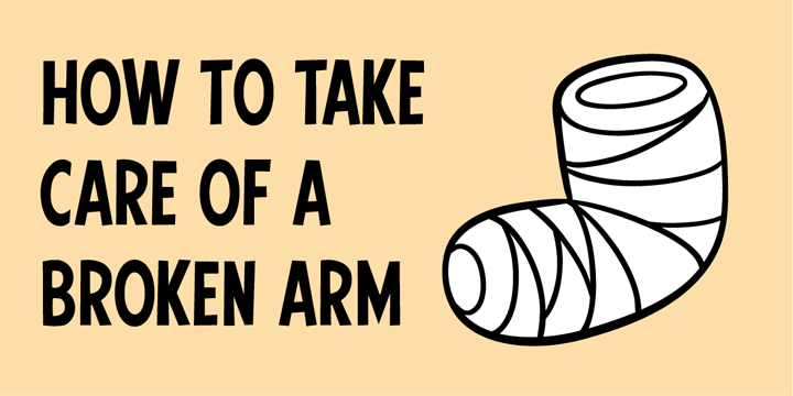 How to take care of a broken arm